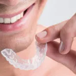 Migliore apparecchio invisibile per denti storti 2023: classifica e guida all’acquisto