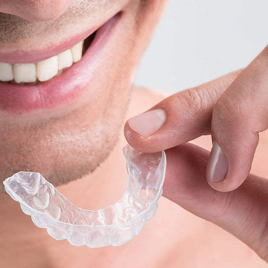 apparecchio invisibile per denti