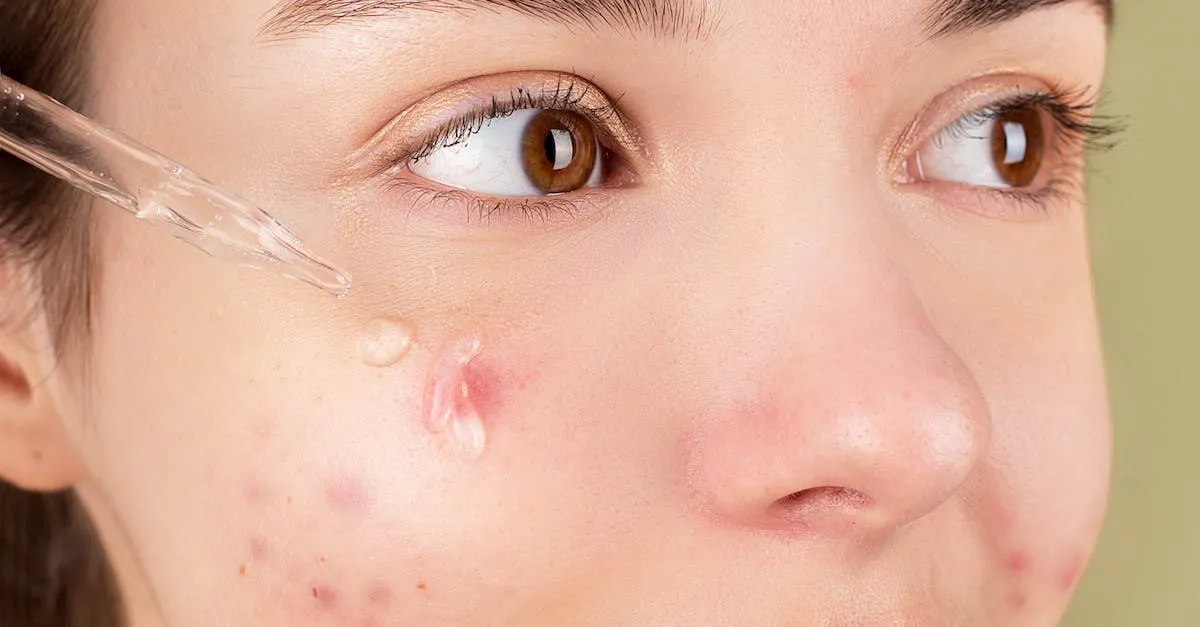 Come eliminare i brufoli: consigli e rimedi efficaci per una pelle senza imperfezioni